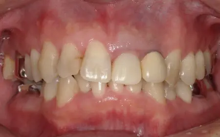 Before image