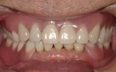 After image