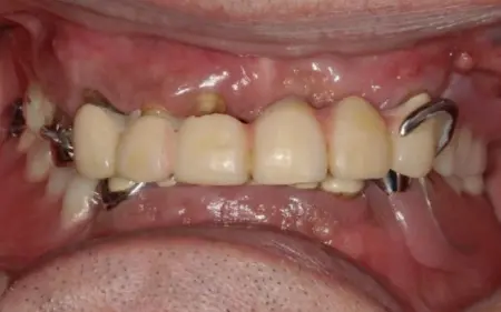 Before image