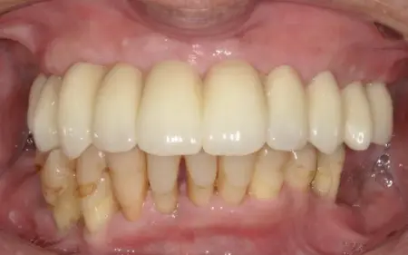 After image