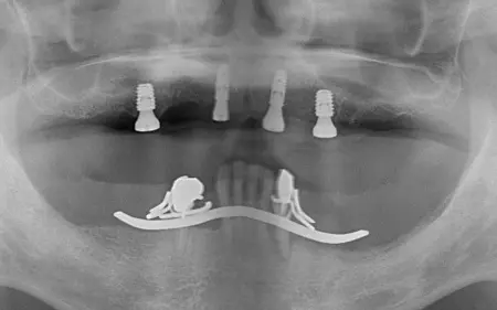 After image