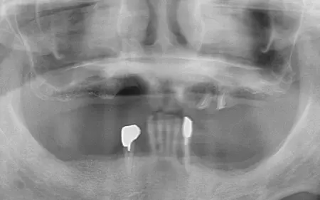 Before image