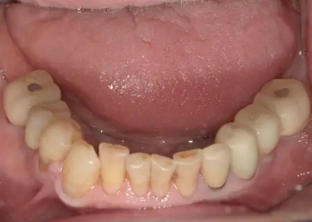 After image