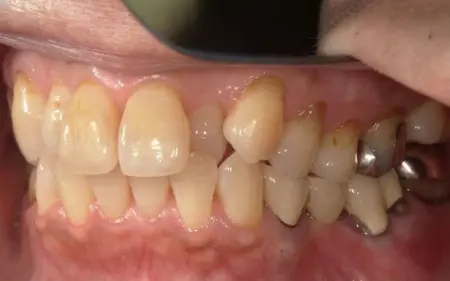 Before image