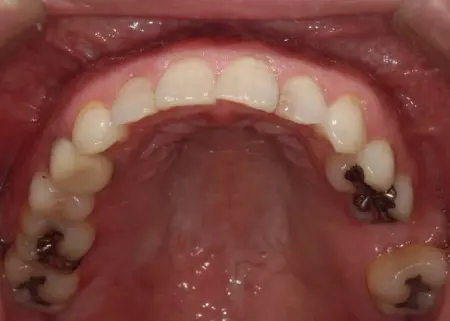 Before image