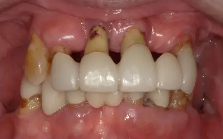 Before image